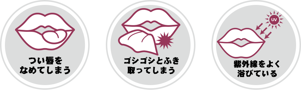 つい唇をなめてしまう、ごしごしとふき取ってしまう、紫外線をよく